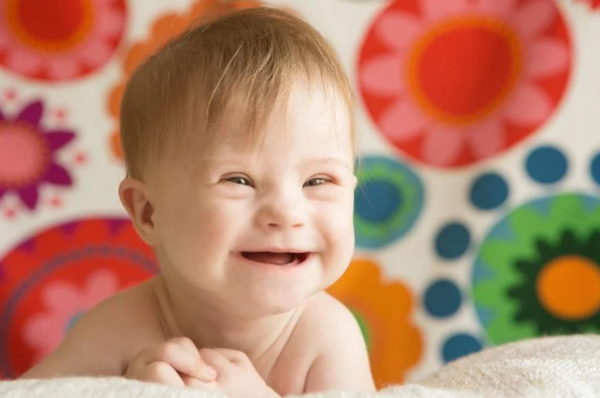 Lo que debes saber antes de atender a un niño con Síndrome de Down en tu clínica