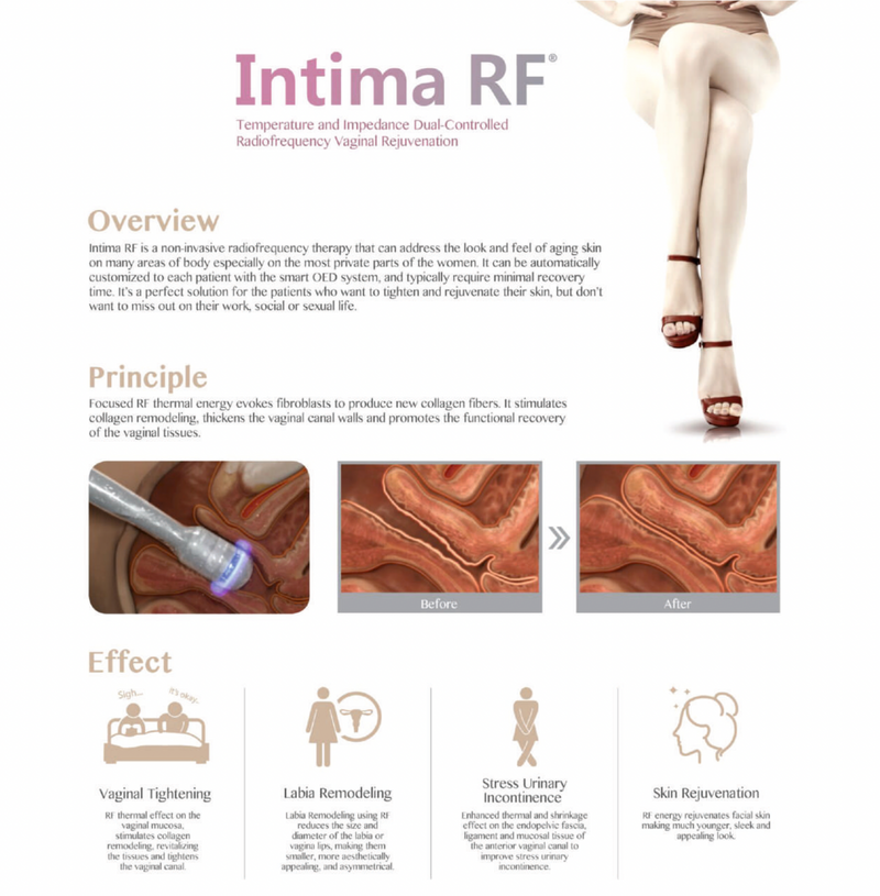 Intima RF